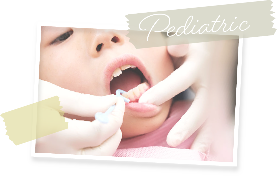 大切なお子さんの歯を守るため